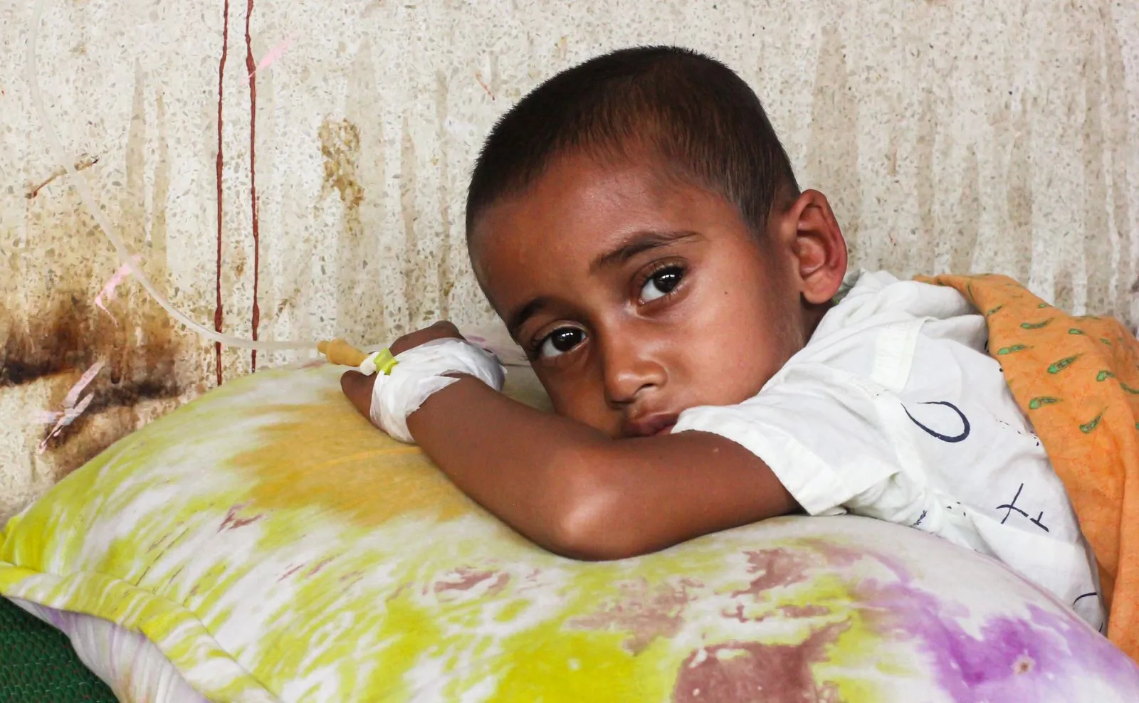 A young boy resting on a pillow in hospital with an IV line in his hand